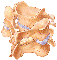 Posterior Cervical Fusion